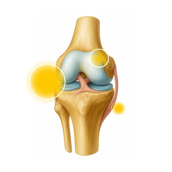 Gliukozaminas ir chondroitinas - sąnarių priežiūros pagrindas